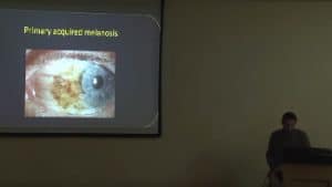 אונקולוגיה של העין, הרצאה שלישית - פרופ' פביאן